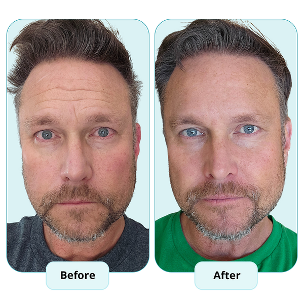 Erase Years in Seconds with Age-Defying Tallow Honey Balm!