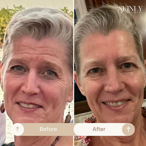 SmoothSkin Face Tape