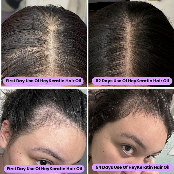 HeyKeratin Hair Growth Boost